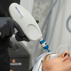 Skin Resurfacing - iPixel featured image